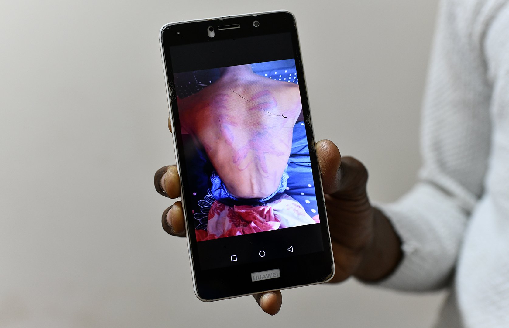 This is photo shows a cellpone held by a Sudanese refugee in Cairo. The cellphone displays a photograph of a friend who sustained injuries after being held for two days in a makeshift detention centre run by the Rapid Support Forces in Omdurman.