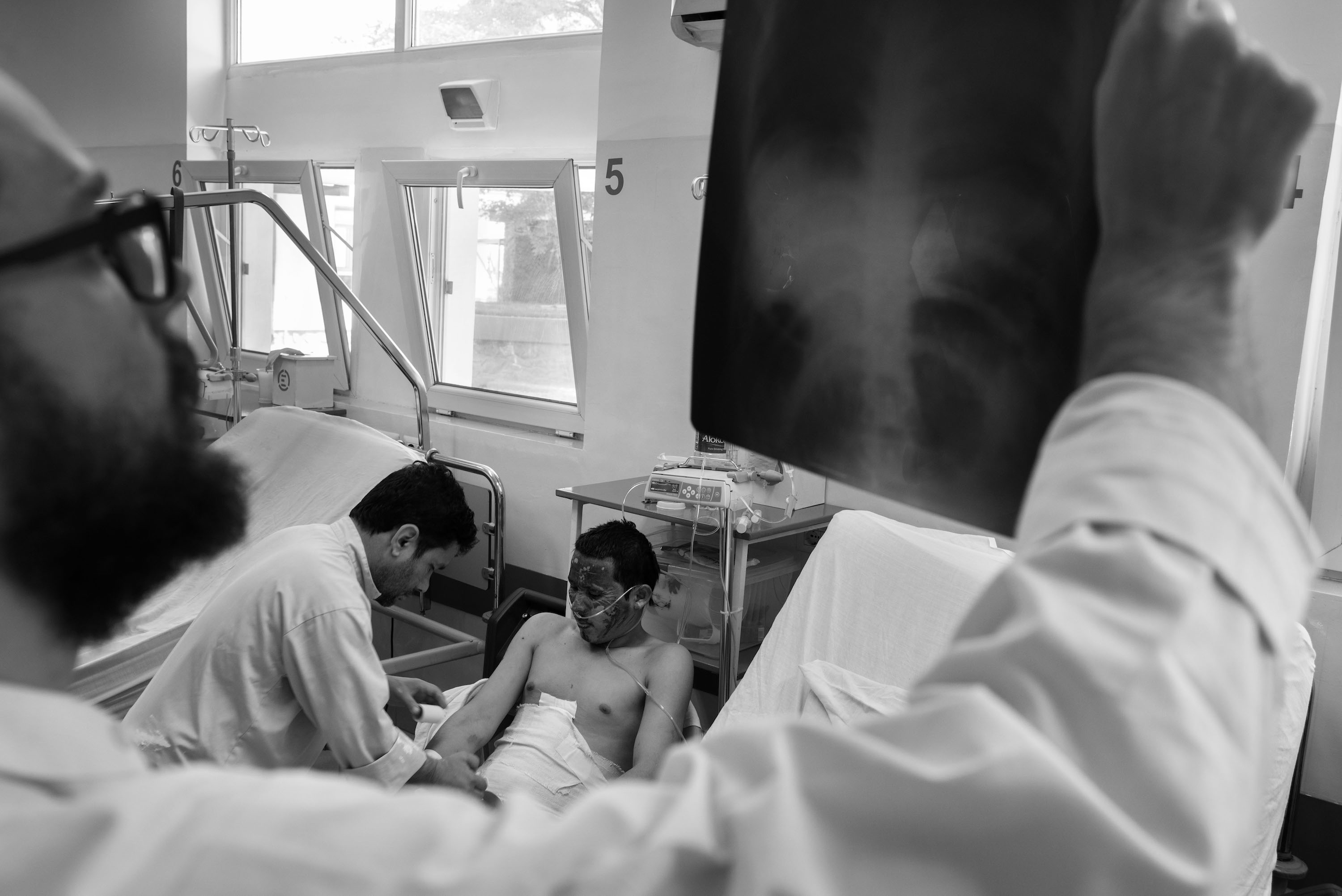 A doctor holds up x-rays in foreground, while patient with burned face is attended to on hospital bed