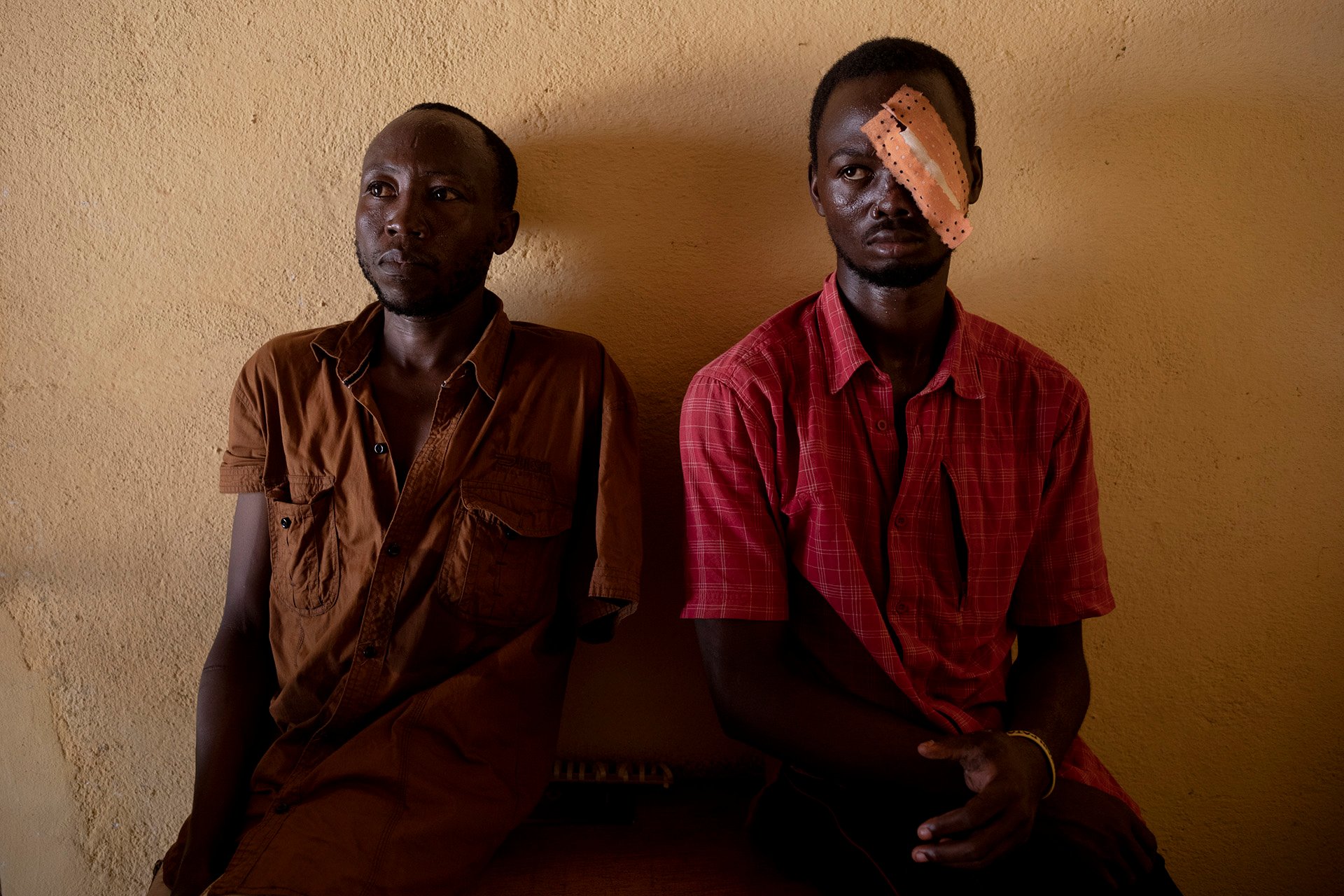 Two men sit on a wooden bench up against a cement wall. One of them wears a patch over his left eye. 