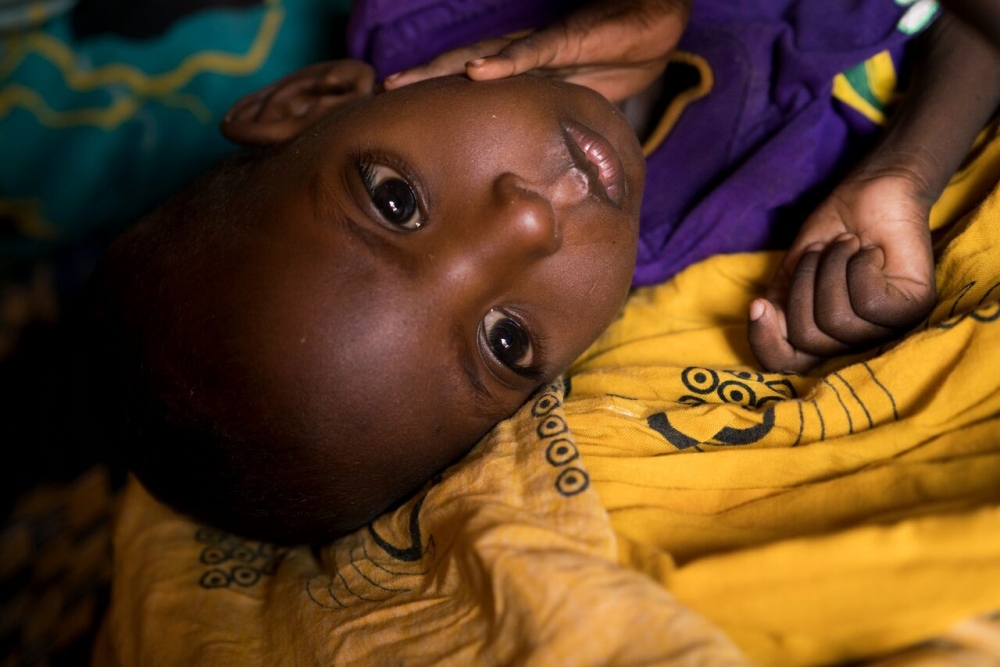 Ahmed, age two, who is malnourished, lies on the ground of his family's home in Uusgure, Puntland, Somalia.