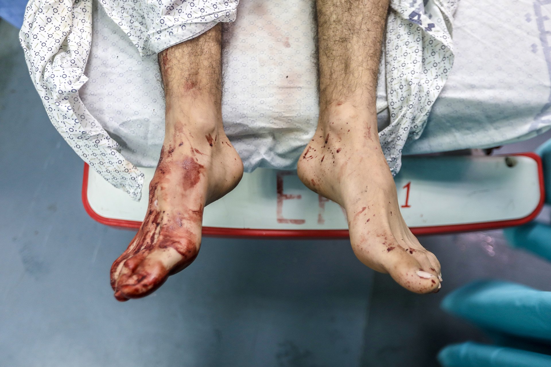 A pair of feet stick out from beyond the edge of a hospital bed. 