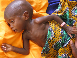 [Mali] Abdoulaye Momina is 20 months old child / baby and severely malnourished. Pictured in August 2005 at Gao District Hospital, Gao, Eastern Mali. He has been receiving specialist treament for 1 week and is starting to recover weight. He is from a poor