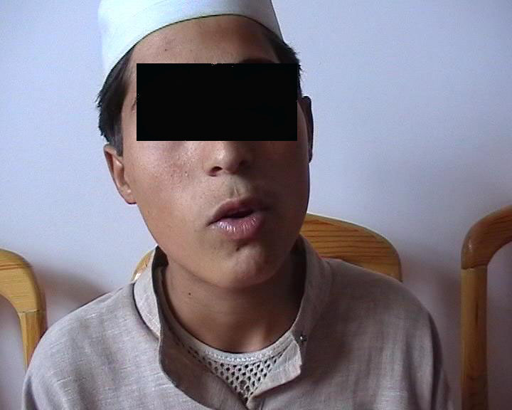 Rohullah, 13, was trained to do suicide attack.