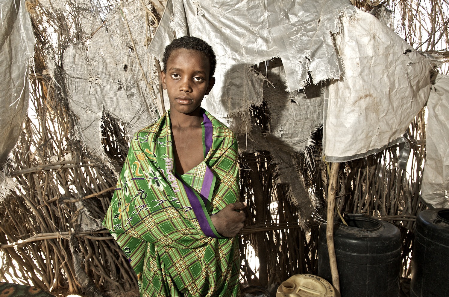 Aftin, twelve, inside his home in El Wak, Kenya. Aftin's family is only able to afford one meal per day. Aftin is experiencing problems with his health as a result of malnutrition