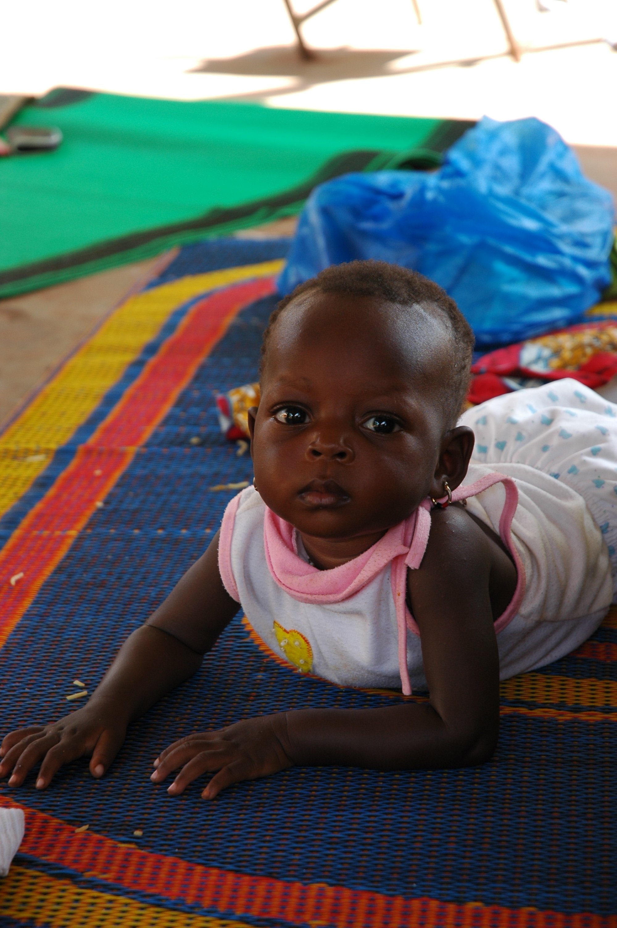 Baby treated for malnutrition at Ouahigouya regional hospital in northwestern Burkina Faso