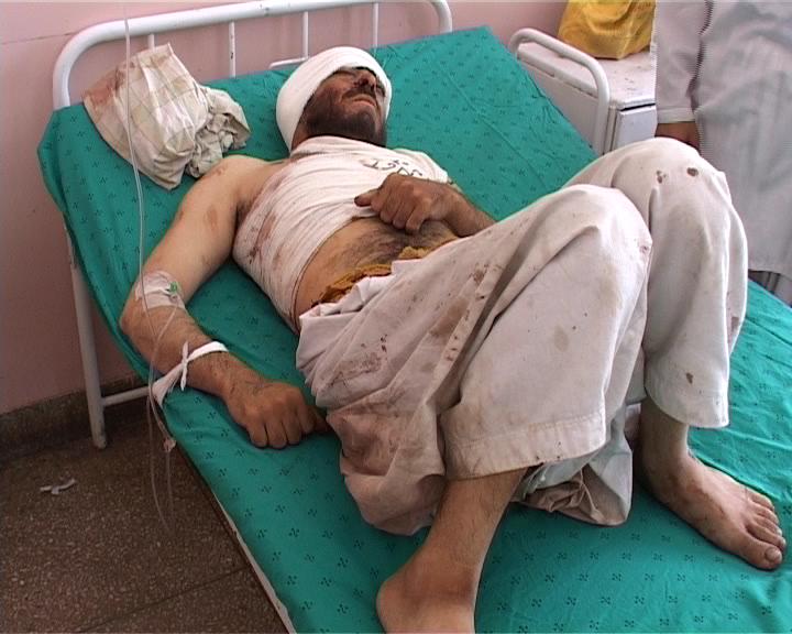 An injured man laying at a bed in Mirwais Hospital in Kandahar Province 