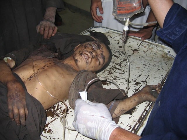 A wounded child in Helmand Province