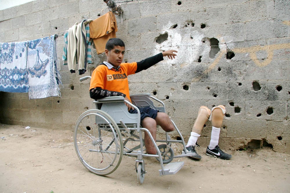 Ghassan Matter, 15, points at holes which the Israeli missiles that hit him on 5 January 2009 made. He lost his legs in the incident and uses artificial limbs now