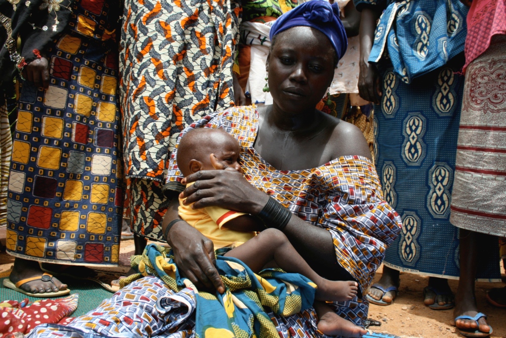 Saratou Mahamadou's 16 months old niece, Rachida, is being treated for severe acute malnutrition in Moghem health centre, in Niger's central region of Tahoua