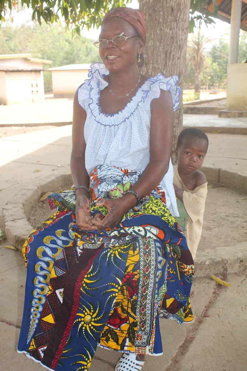 Sister Bernadette works in a leprosy clinic run by nuns in Dimbokro in the centre of the country