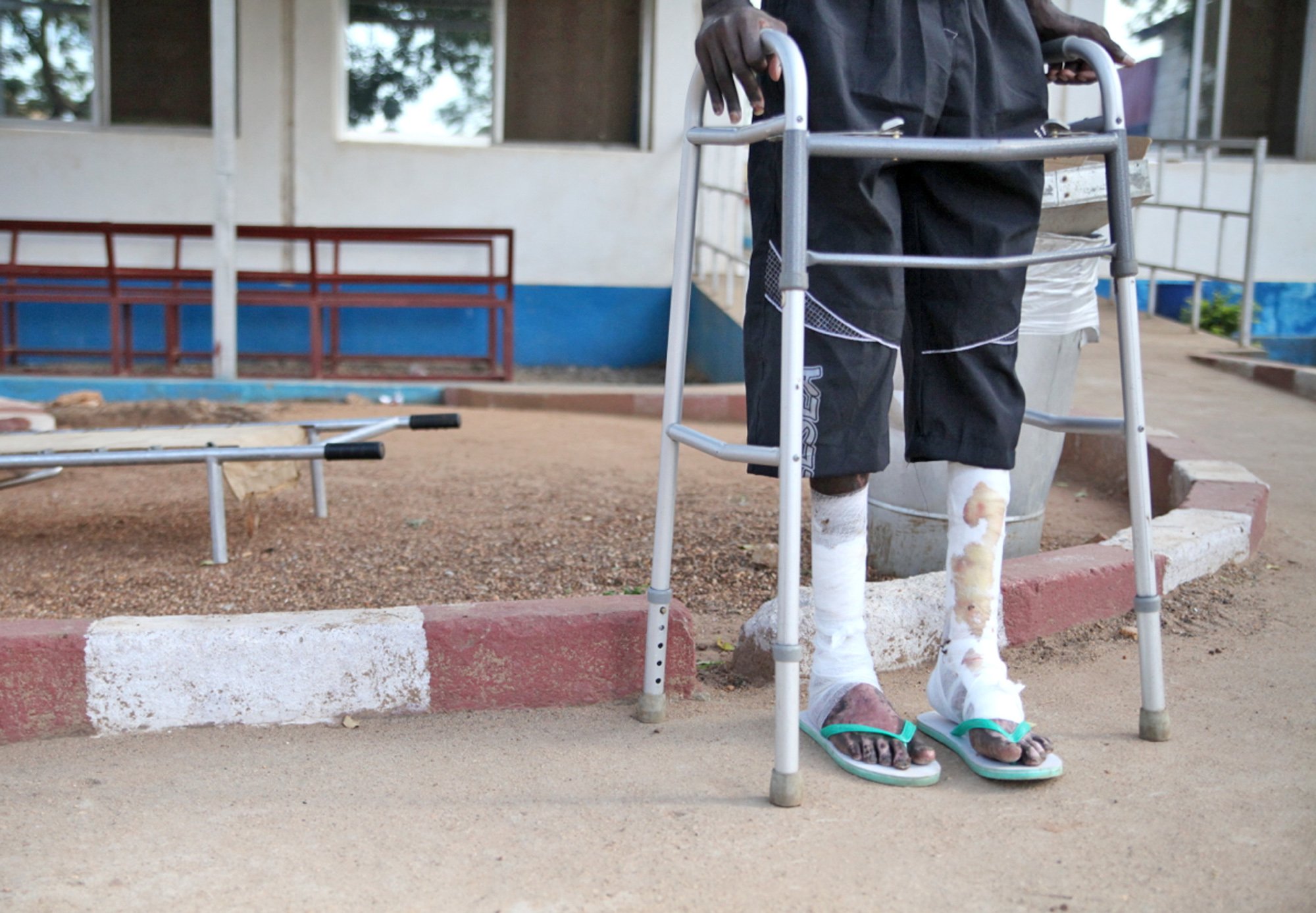 A patient at the military hospital in South Sudan's capital Juba, where many men with post-traumatic-stress-disorder (PTSD) recover from physical and emotional wounds after decades of civil war that led to South Sudan's secession in July 2011