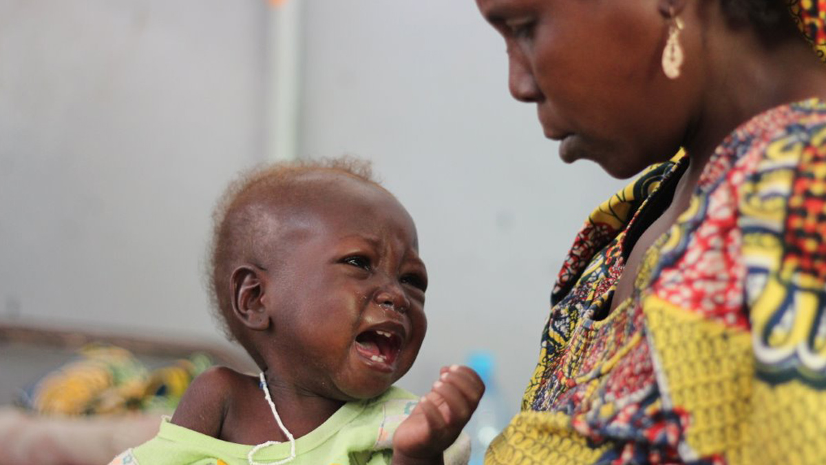 A mother watches her baby at a hospital in Cameroon’s Far North Region. Some 58,000 children under five have been afflicted by severe malnutrition in the Far North and North regions of Cameroon this year