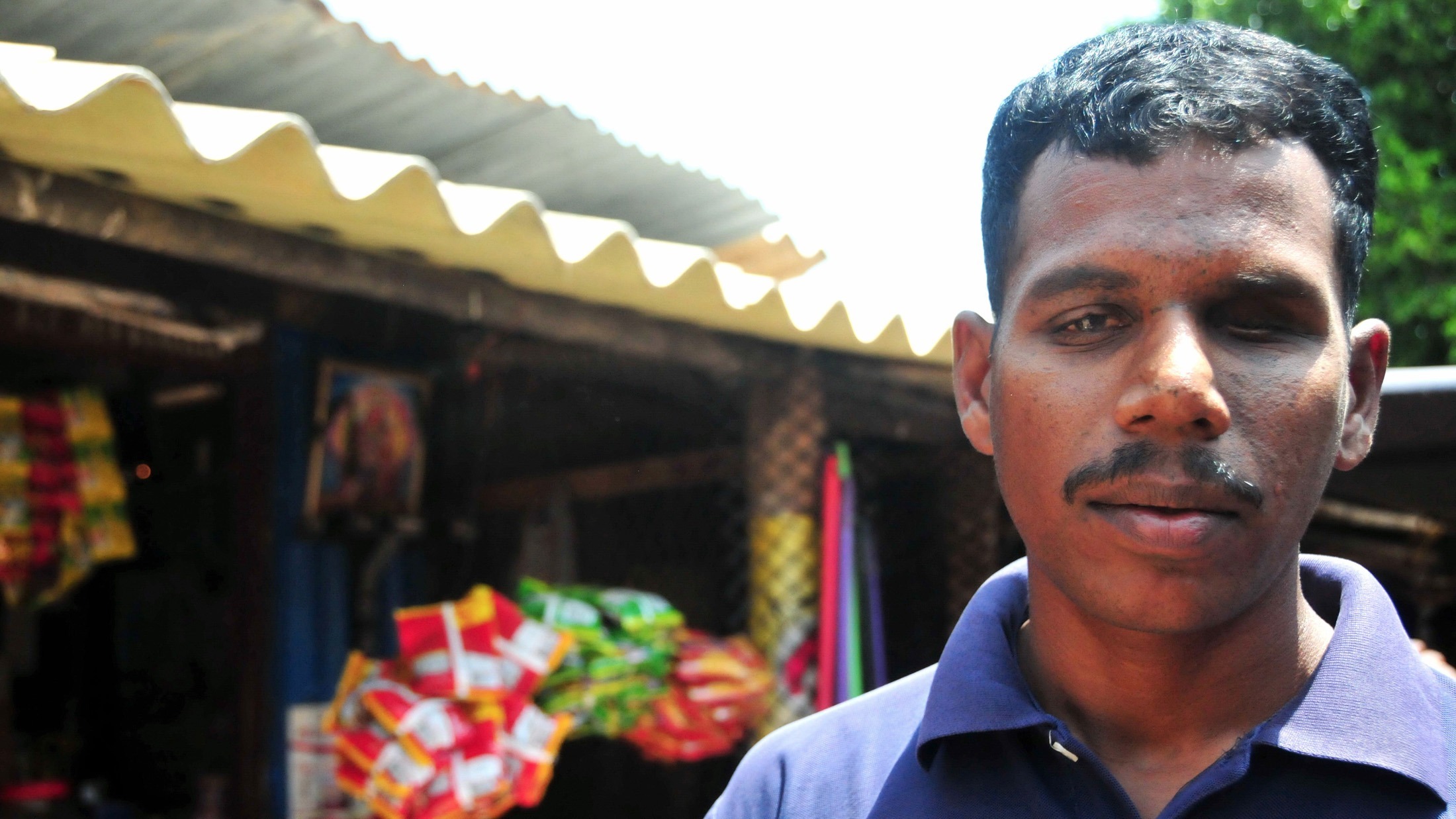  Rasalingam Sivakumar, a former LTTE combatant, lost sight in his left eye during Sri Lanka's civil war, and is almost blind in his right eye. He is struggling to look after a wife and two young children.