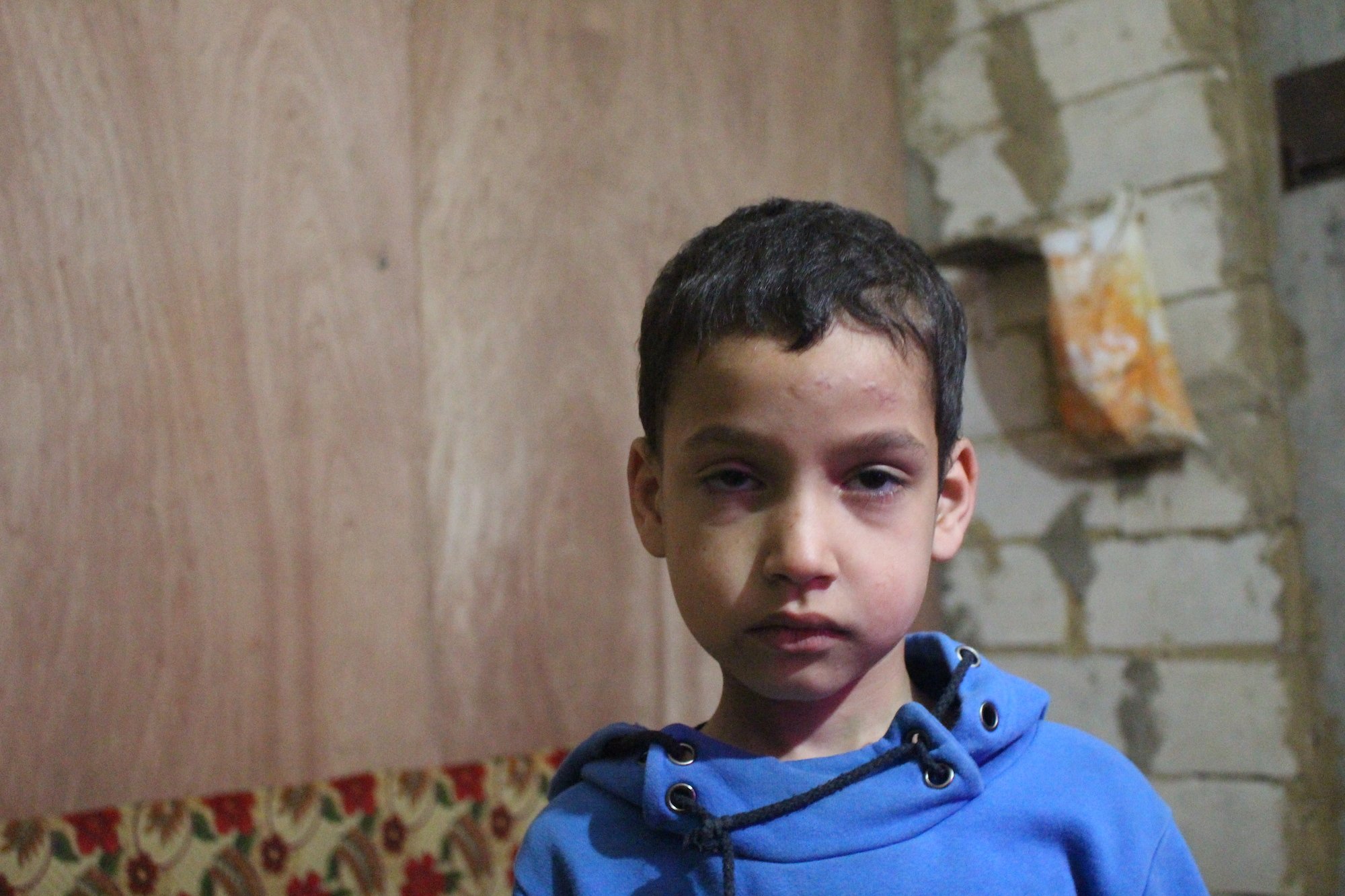 Mohammed, 7, a Syrian refugee from Homs now in Lebanon, was injured when the ceiling of the underground car park his family are staying collapsed