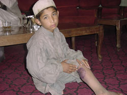 [Afghanistan] Leishmaniasis: a disfiguring skin disease.
