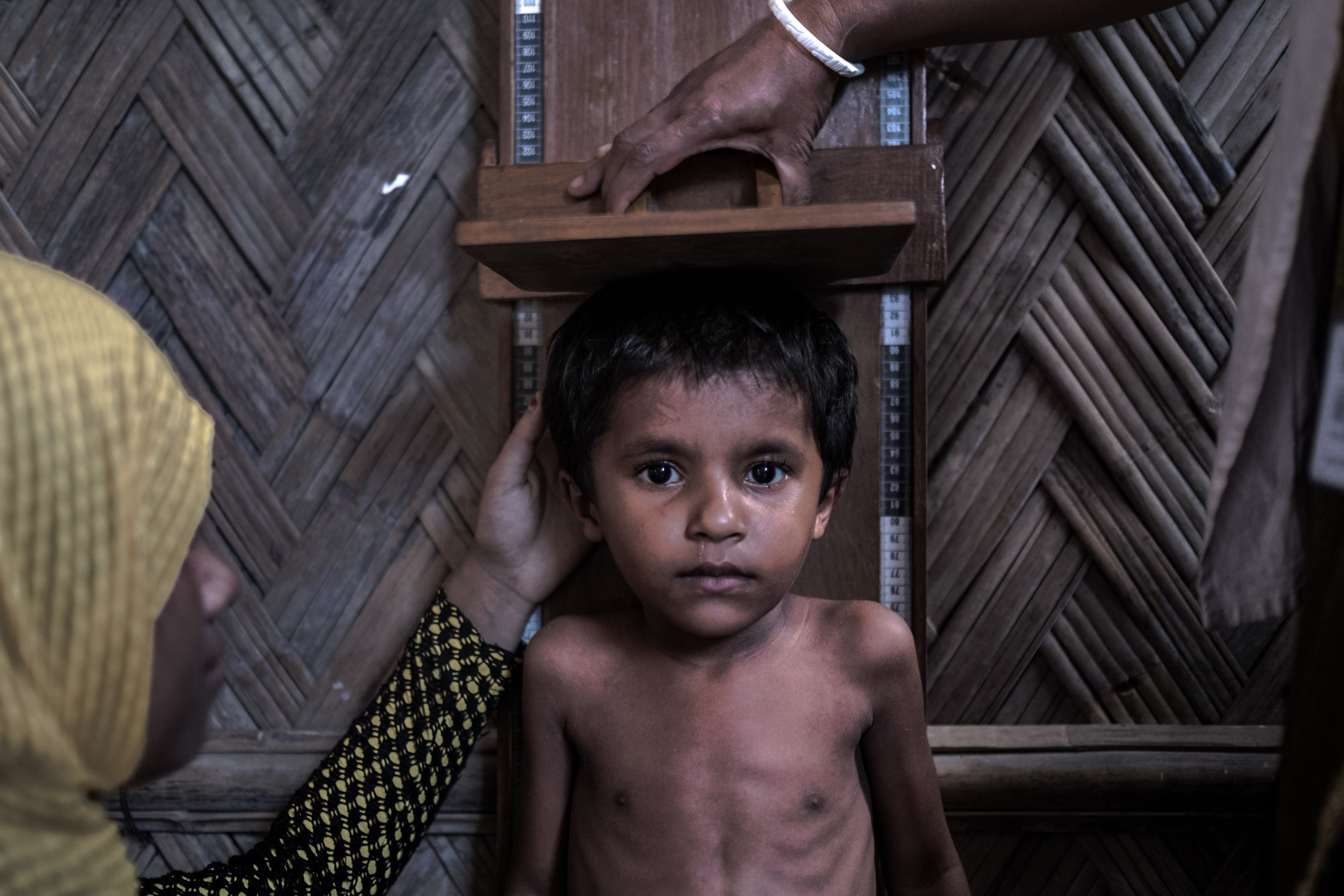 Health workers measure Rohingya child