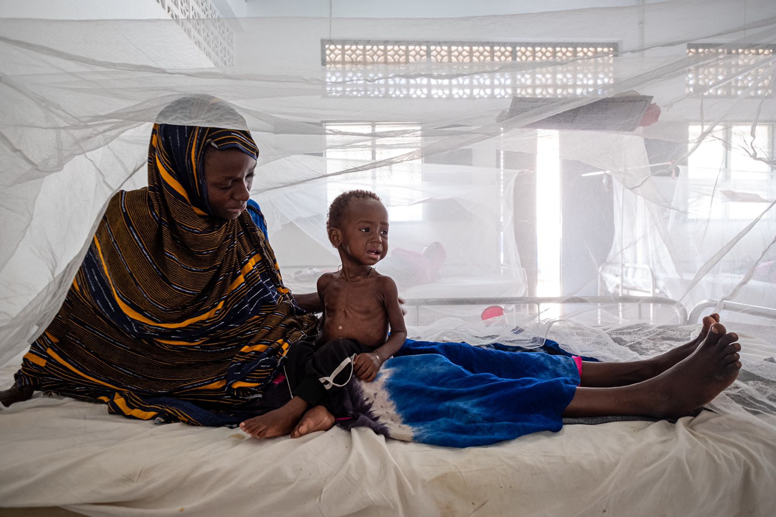 Haawo Abass with her son, Abdelnasr, at the stabilisation centre in Kismayo. Sixteen-month-old Abdelnasr suffers from kwashiorkor, a severe form of malnutrition.