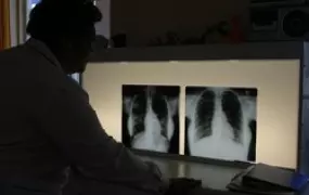 [South Africa] TB diagnosis.