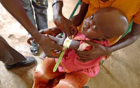 Upper arm measurements at Merlin run Boma hospital, Jonglei state Malnutiriton is a major contributory factor to the prevalence and mortality of neglected tropical diseases in South Sudan