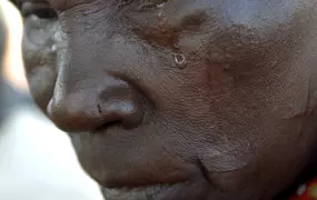 One of the 321 people in a village of 3,000 residents living with leprosy in a leper colony, founded in 1952. The stigma of leprosy puts the people on the margins of society where they are reliant on limited food aid and other assistance while living in m