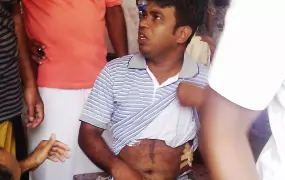 A man injured in communal violence between Muslims and Buddhists in Sri Lanka, which broke out after years of simmering tensions.  