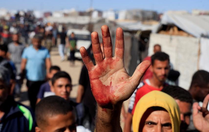 A Palestinian man shows blood stains on his palm after carrying casualties among people seeking aid from the US- and Israeli-backed Gaza Humanitarian Foundation at the end of May 2025.