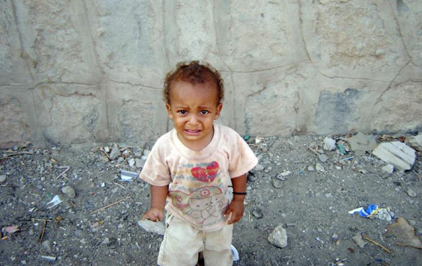 A Somali refugee child suffers the miserable conditions of the al-Basateen area of Aden province, Yemen.