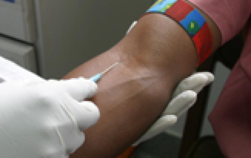 blood sample.
