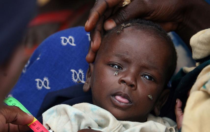 A malnourished child examined by an officer from the UN Children’s Fund, Jowhar, Somalia, September 2007. Malnutrition rates are soaring. About 17 percent of children nationwide are malnourished, according to UNICEF. About 13,500 children are so severel