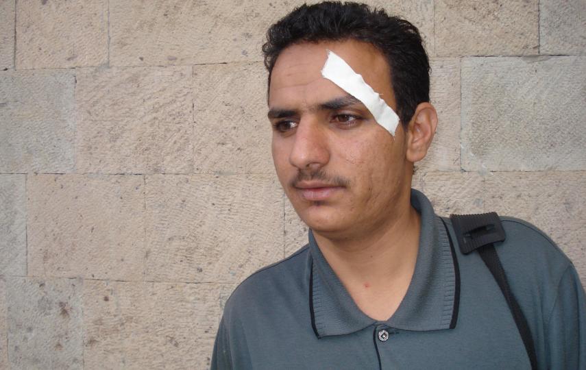 Saddam al-Ashmori, a 26-year-old Yemeni freelance journalist, was attacked earlier this month and now fears for his safety.