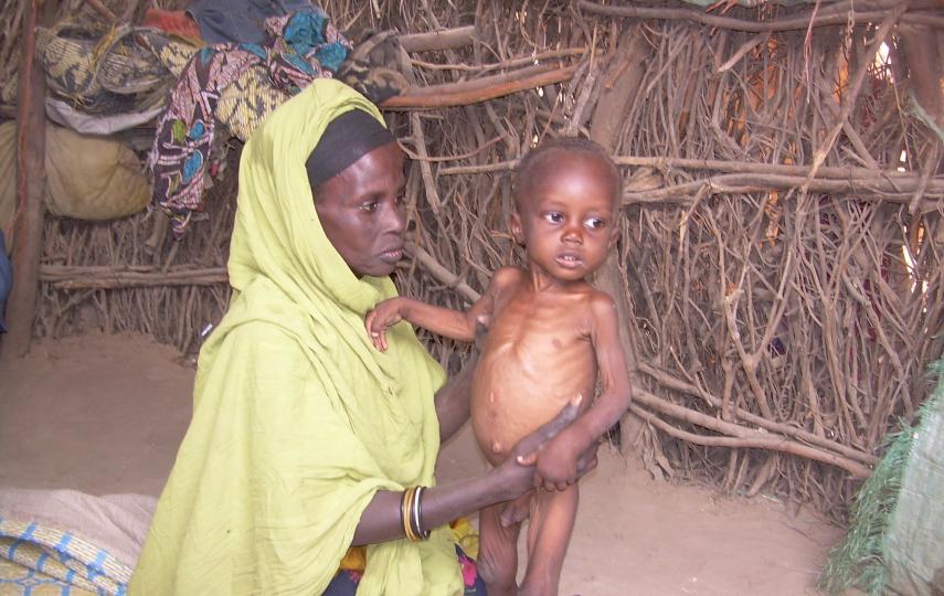 A mother and her malnourished child in Beletweyne, Hiiraan region of central Somalia.