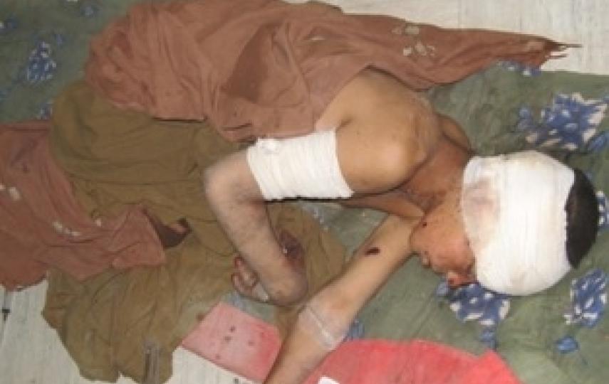 Children have shared the brunt of conflict casualties in the war in Afghanistan