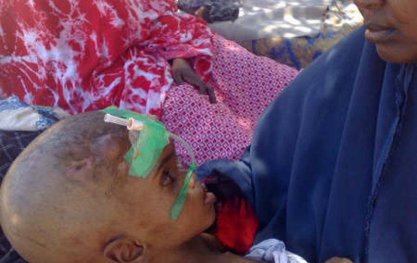 Lul Ali Hassan with her ailing three-year-old child at Benadir Hospital in Mogadishu, capital of Somalia