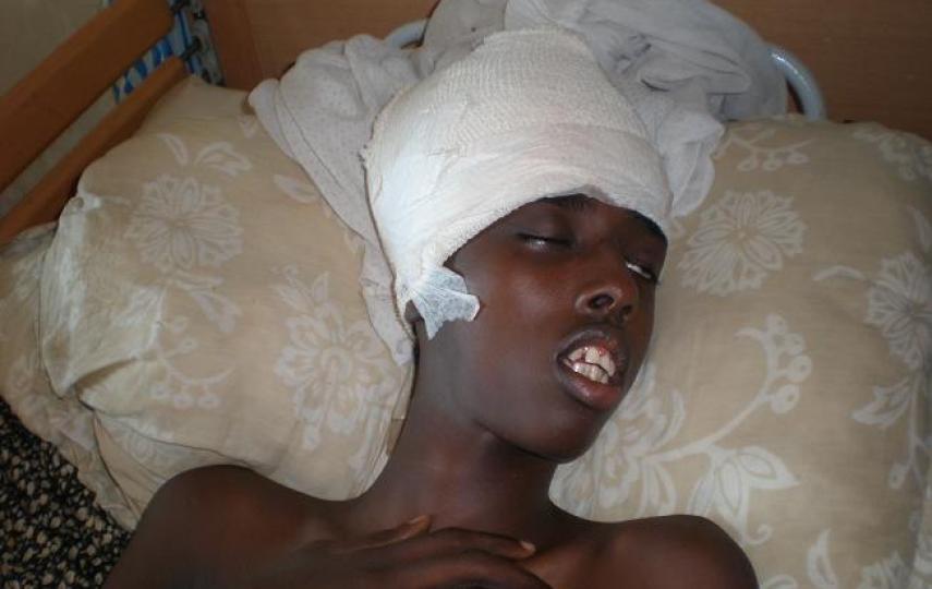 A young man injured in the fighting in Mogadishu at Medina hospital