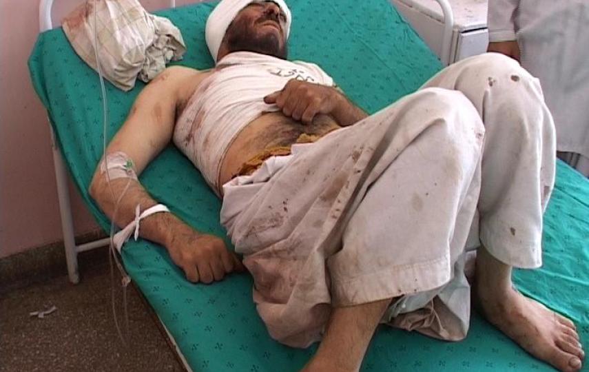 An injured man laying at a bed in Mirwais Hospital in Kandahar Province 