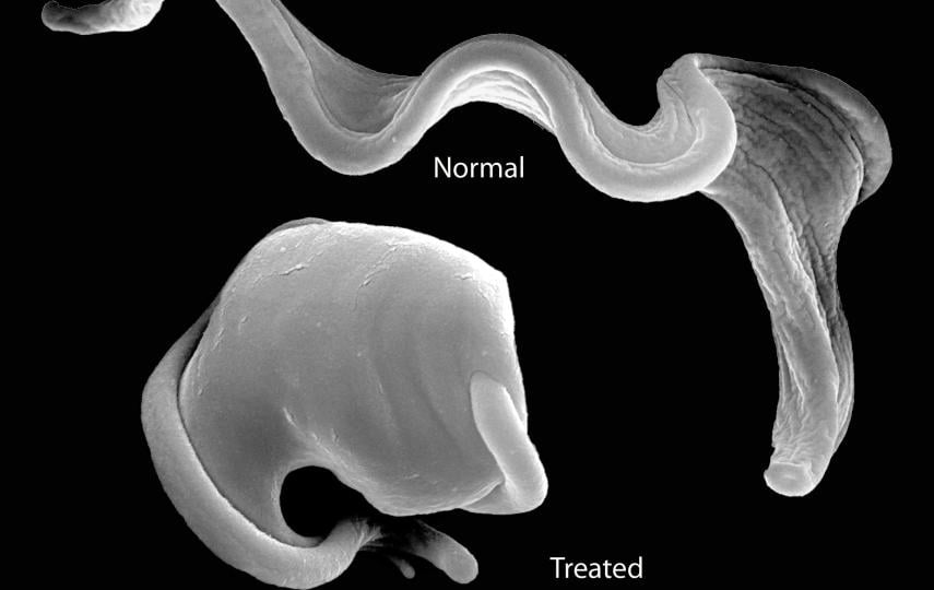 The parasite trypanosome in its normal state (top) and then treated with the drug and about to `explode'