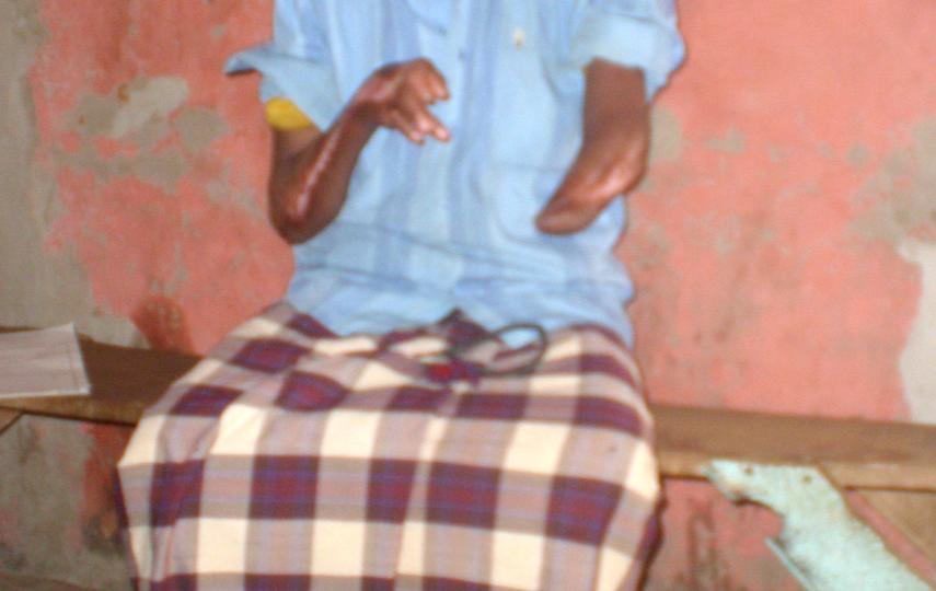 This Somali man lost his hands when al-Shabab insurgents suspended him by his arms from a tree for more than 24 hours because he refused to pay them “tax”
