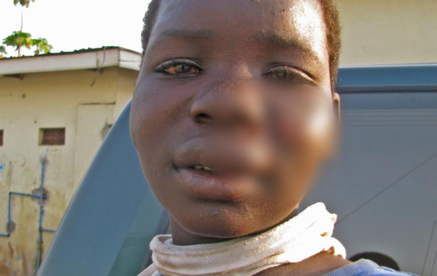 Ajal Kaba, a street child in Juba, capital of South Sudan