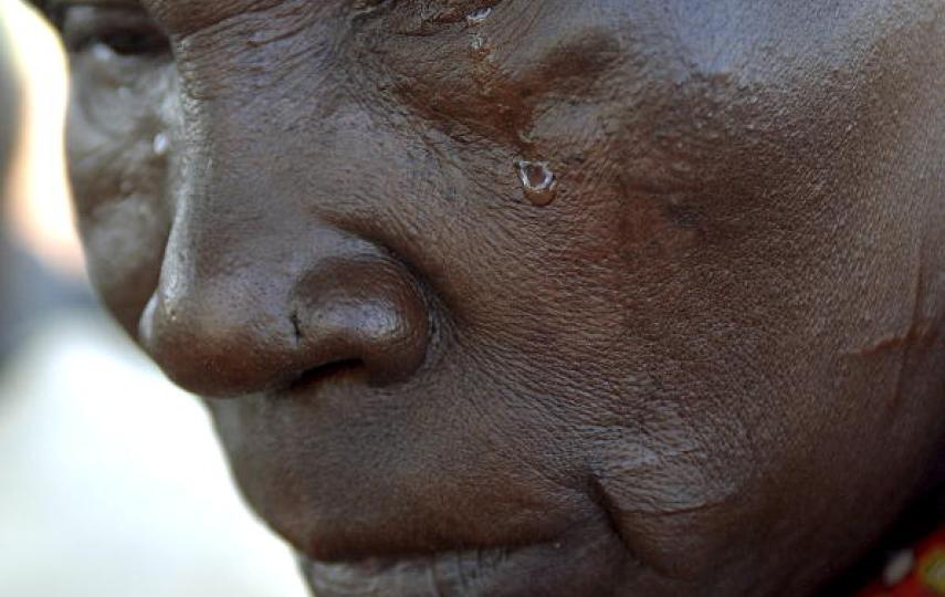 One of the 321 people in a village of 3,000 residents living with leprosy in a leper colony, founded in 1952. The stigma of leprosy puts the people on the margins of society where they are reliant on limited food aid and other assistance while living in m
