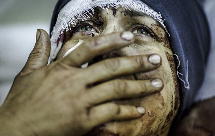Aida, 32, reacts as she recovers from severe injuries. She has lost her husband and two children after the Syrian Army shelled her house in Idlib, north Syria