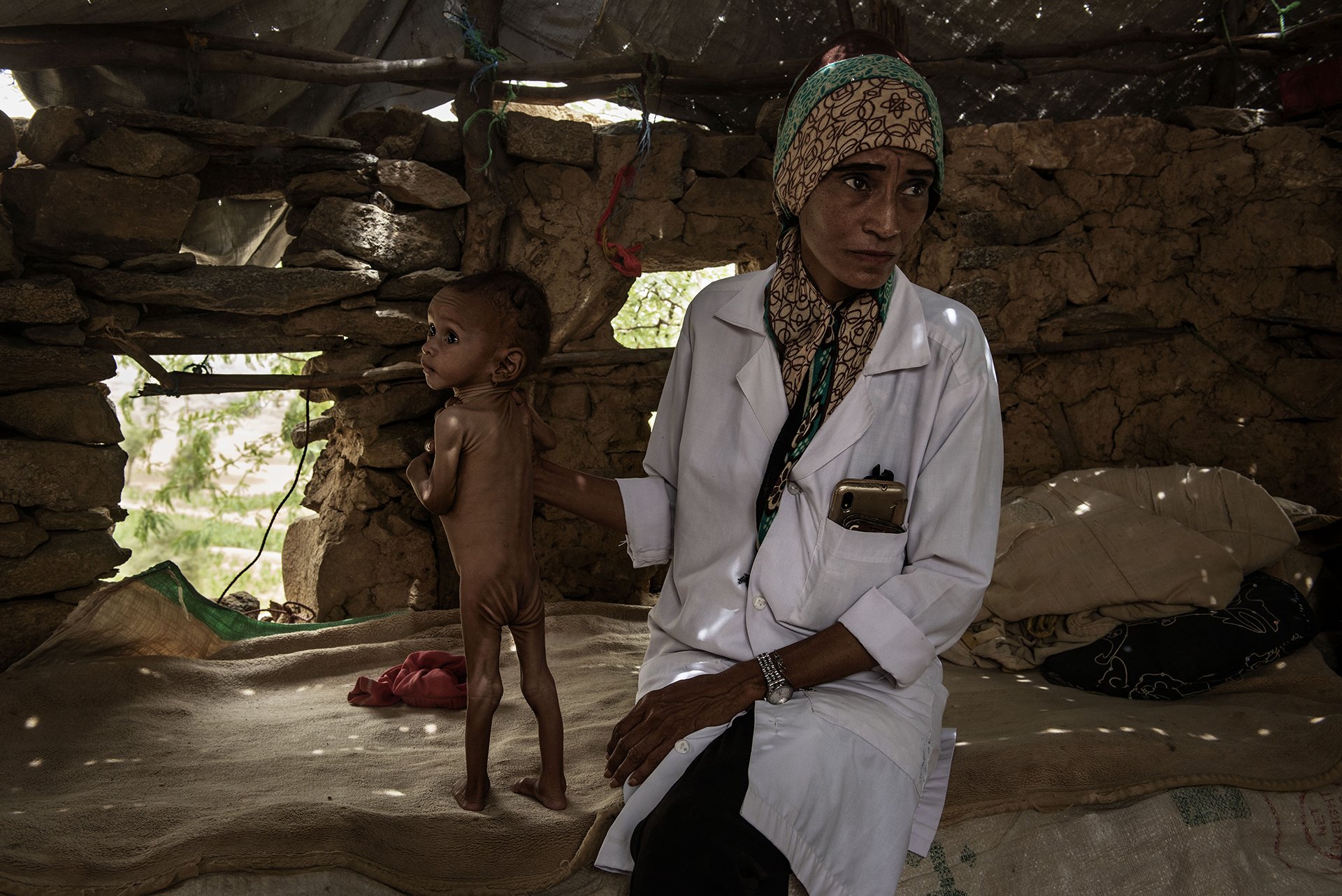 Photo of a nurse and a malnourished child in rural Yemen